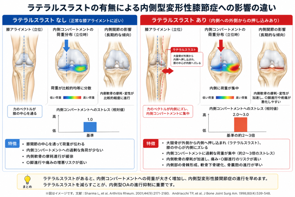東京ひざ痛専門整体院京四郎
ラテラススラスト
変形性膝関節症