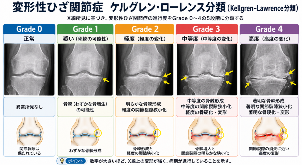 東京ひざ痛専門整体院京四郎
変形性ひざ関節症