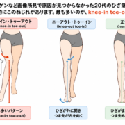 東京ひざ痛専門整体院京四郎