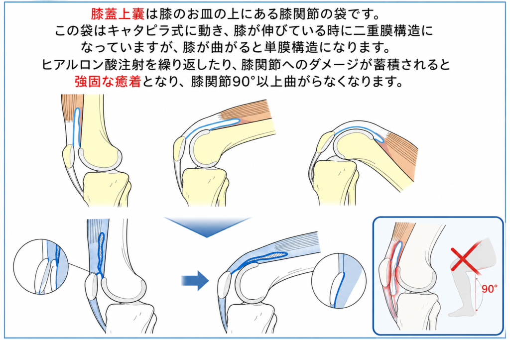 東京ひざ痛専門整体院京四郎